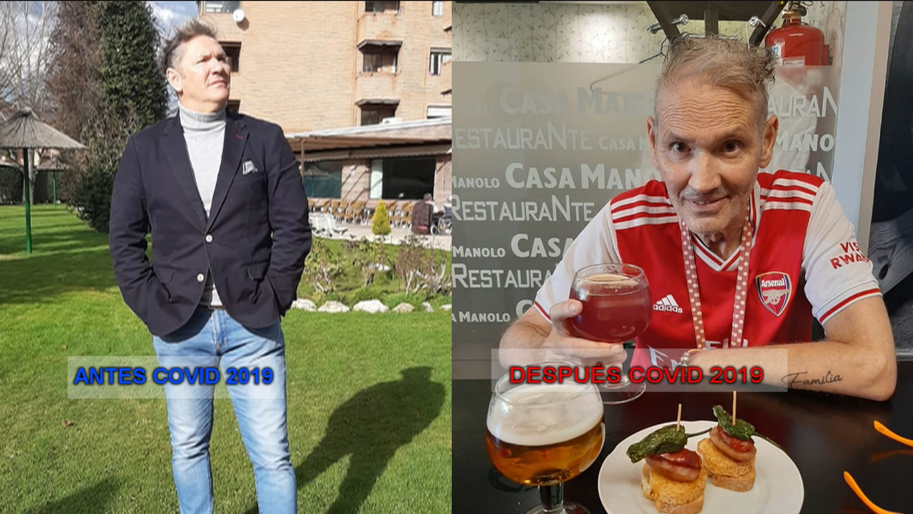 El antes y el después de Javier tras permanecer 74 días en la UCI por coronavirus