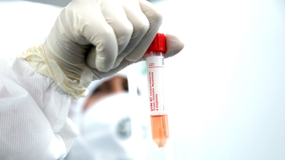 La vacuna europea podría llegar a finales de noviembre, pero solo para un 6% de la población