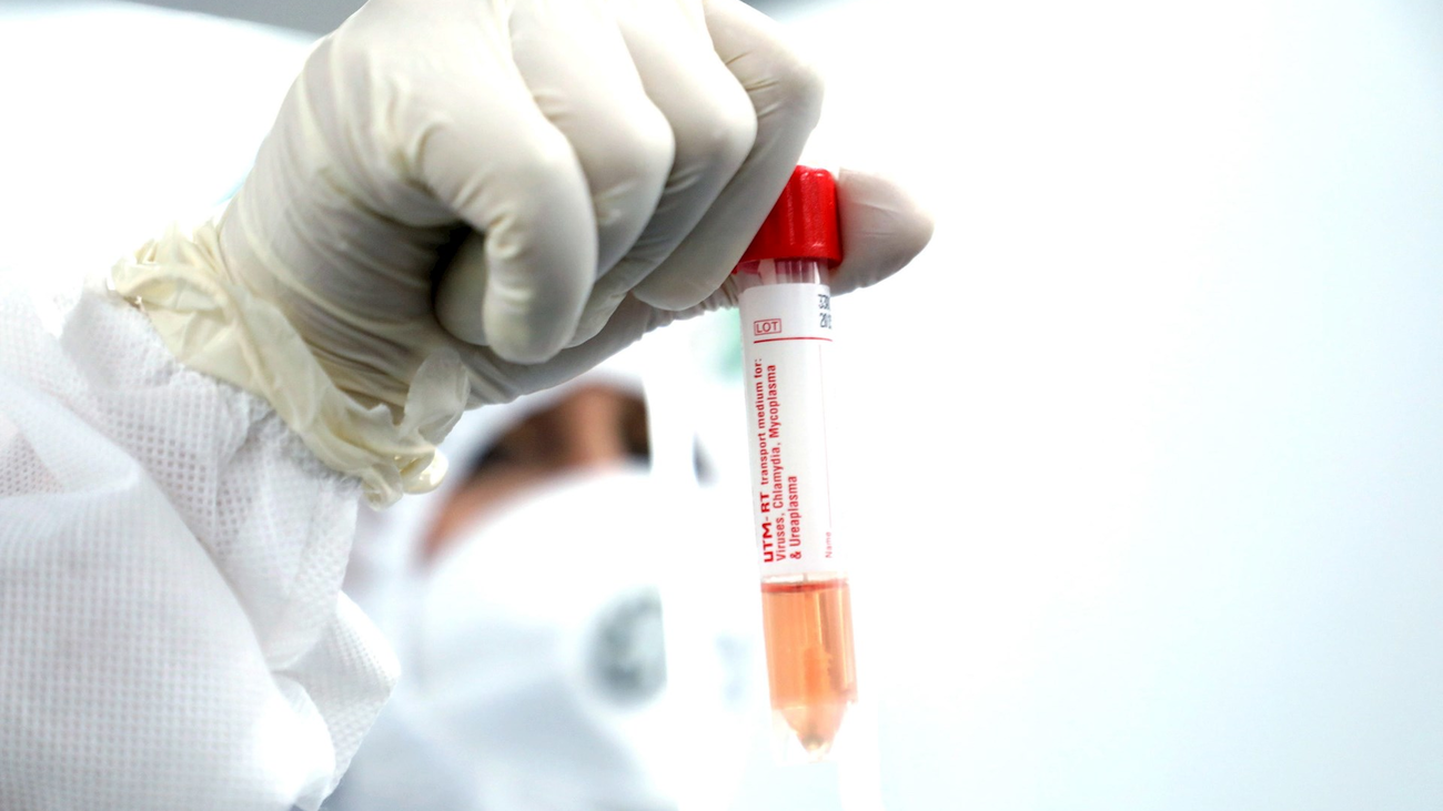 La vacuna europea podría llegar a finales de noviembre, pero solo para un 6% de la población