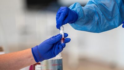 Madrid reduce los contagios en una semana por primera vez desde julio