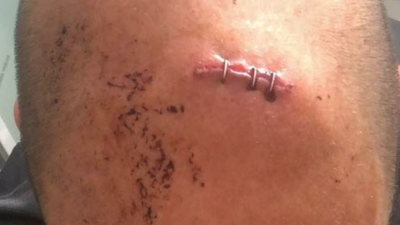 Un policía herido por bandas latinas en el Parque Calero de Ciudad Lineal