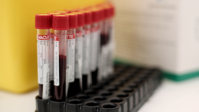 Más contagios en Torrejón, preocupada por entrar entre las zonas con restricciones