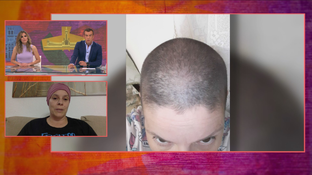 Secuelas de la covid en una mujer de 44 años: “Tengo alopecia, náuseas, dolores articulares y musculares”