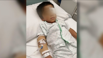 Un niño de 3 años sufre graves lesiones en un ojo porque un compañero le lanzó gel hidroalcohólico