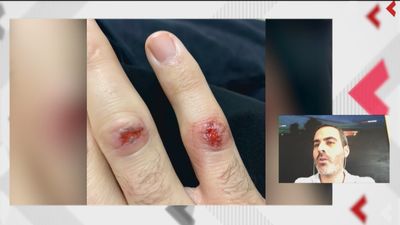 Agredido por ir a su cita presencial en el SEPE: “Me esposaron a una barandilla y me dieron con una porra”