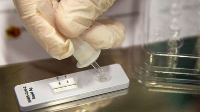 Sanidad  comunica 15.318 nuevos contagios y 351 fallecimientos por Covid en España