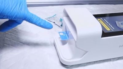 Los nuevos test que detectan el coronavirus en 12 minutos