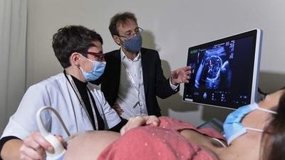 Barcelona  lidera el primer proyecto de placenta artificial en Europa
