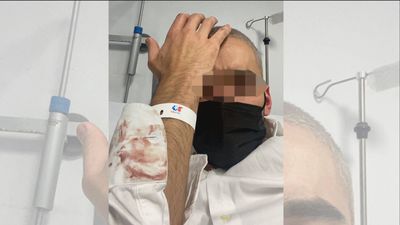 Sufre cortes en todo su cuerpo tras una agresión homófoba en un bar de Chamberí