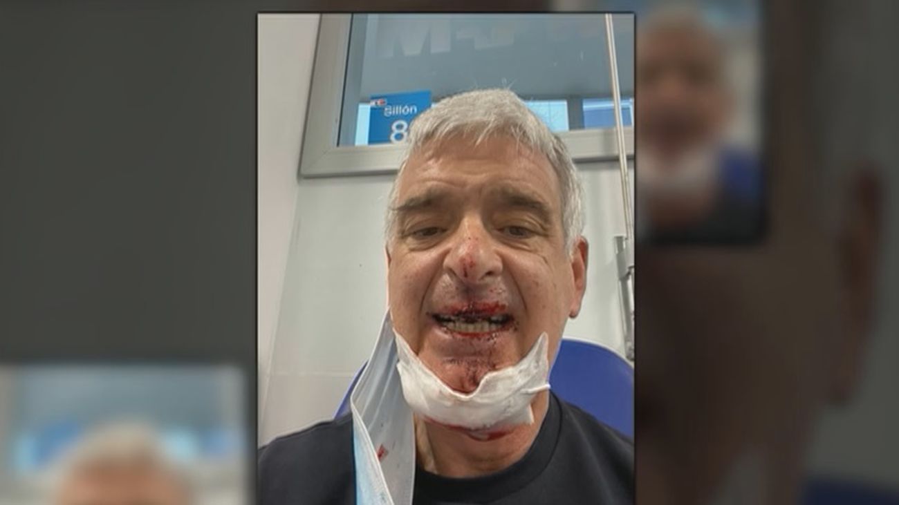 Un ciclista sufre un grave accidente por el mal estado de una alcantarilla en Majadahonda