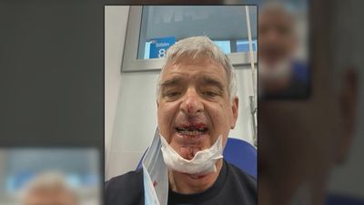 Un ciclista sufre un grave accidente por el mal estado de una alcantarilla en Majadahonda