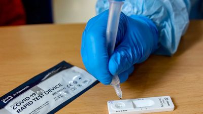 Un viaje a Turquía para un injerto capilar provoca un brote masivo de covid