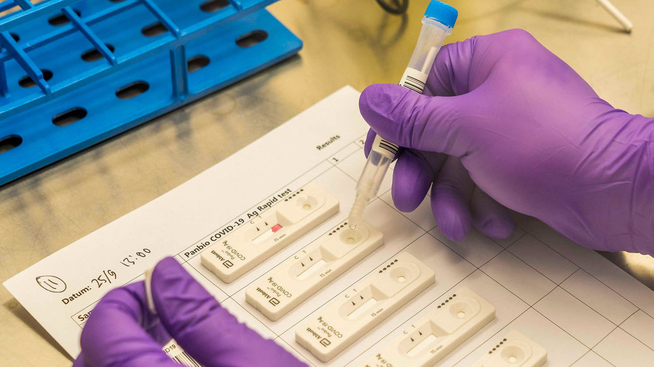 Aplicación de una muestra en el reactivo que detecta la presencia del antígeno