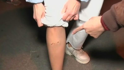 Los perros de unos okupas en Pozuelo atemorizan a los vecinos de una urbanización