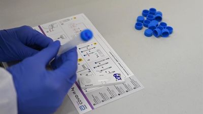 Madrid registra 149 contagios y un fallecido pero aumentan los ingresos