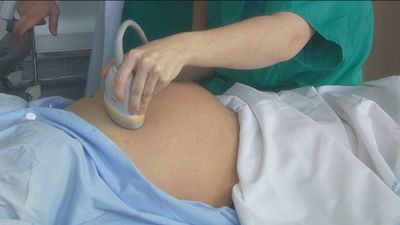 Las embarazadas con covid tienen un riesgo casi inexistente de transmitir el virus a los recién nacidos