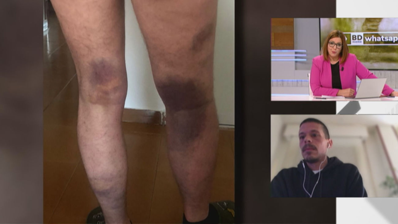 Le apalean y casi le matan en una agresión homófoba en Peñagrande