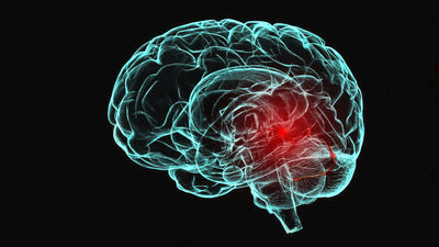 La vida después del daño cerebral