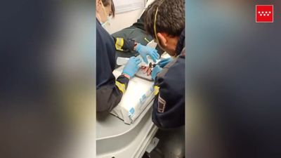 Quitan con una sierra un anillo que 'estrangulaba' el dedo de un niño de Getafe