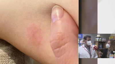 Los mosquitos atacan en Villaverde