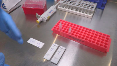 Crece la demanda de pruebas PCR express con el aumento de turismo