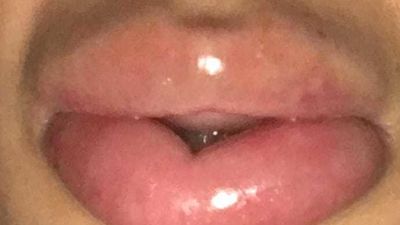 Detenido un vecino de Alcorcón por distribuir un cosmético que provocó graves lesiones a siete mujeres