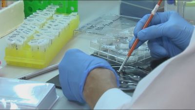 Investigadores del CNIO descubren la causa de la muerte neuronal en los pacientes con ELA familiar