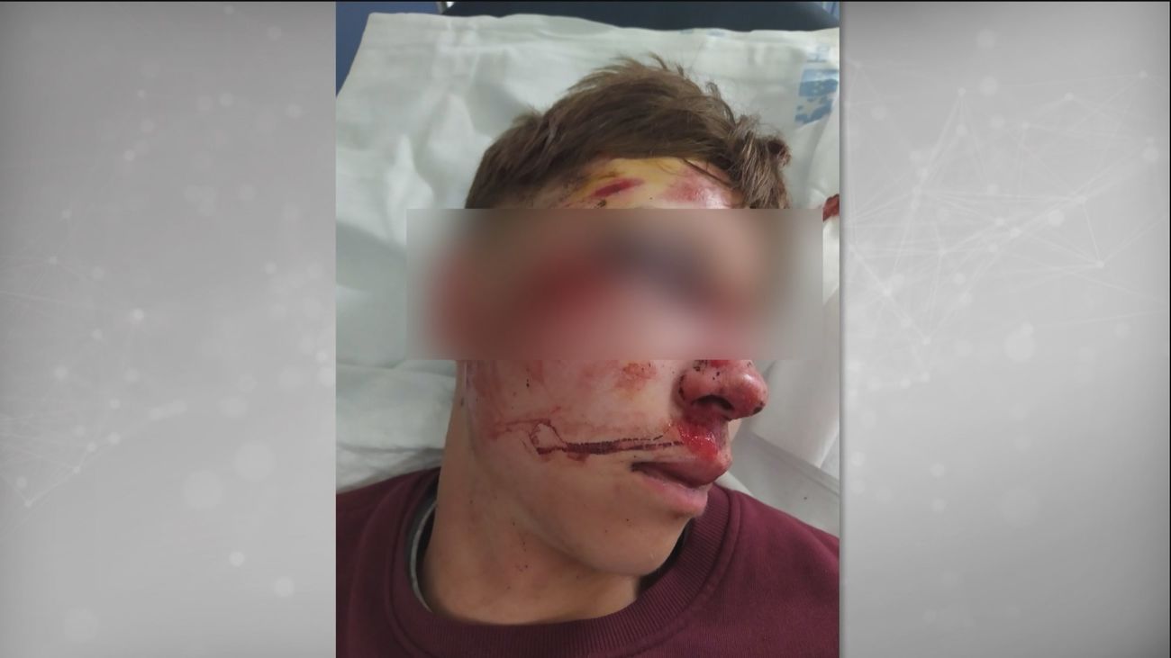 El testimonio de la madre del joven agredido en Parla tras conocer la detención de sus agresores