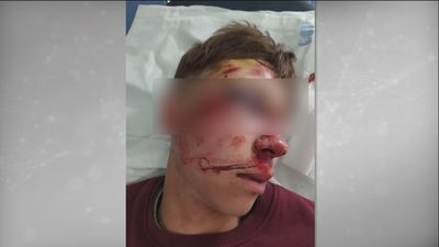 El testimonio de la madre del joven agredido en Parla tras conocer la detención de sus agresores