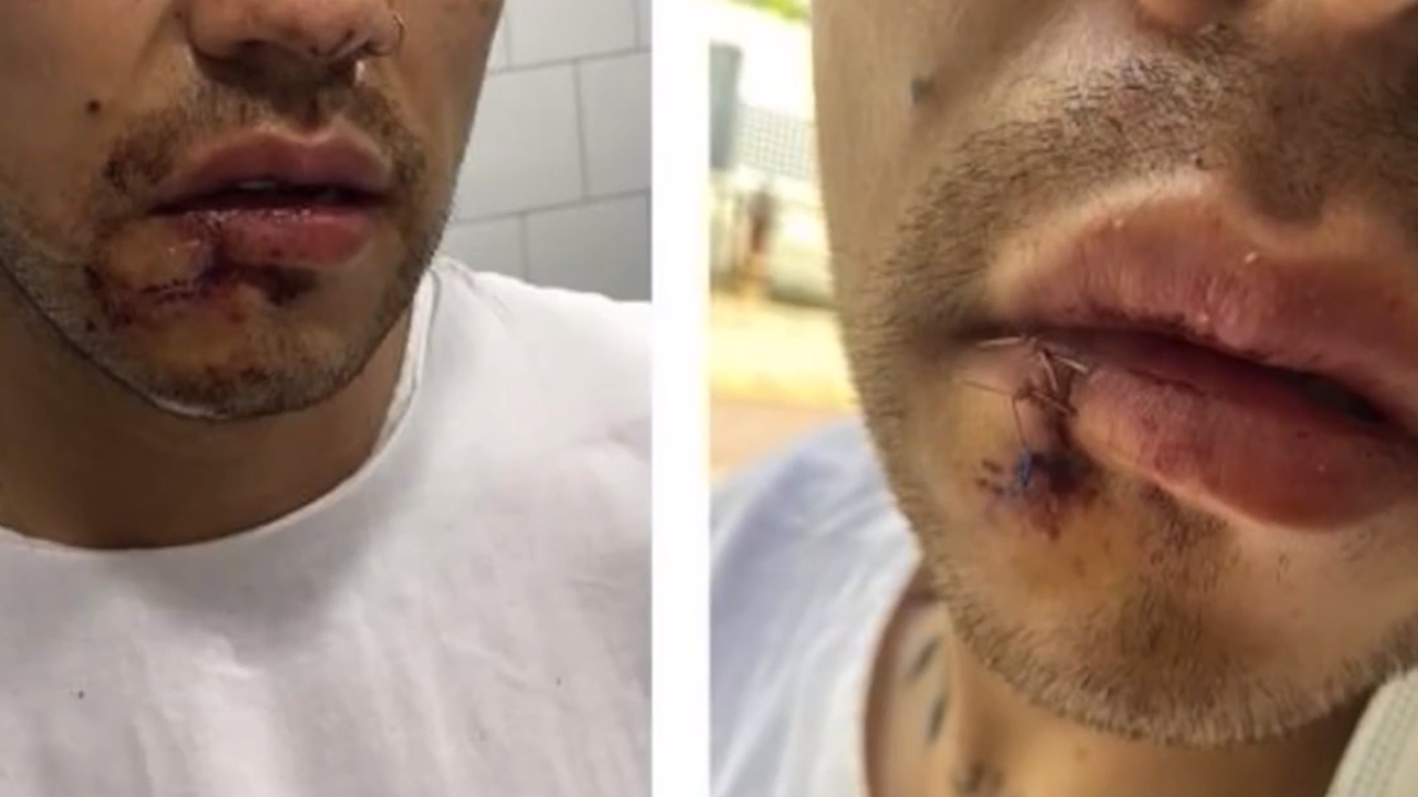 6 víctimas de agresiones homófobas este fin de semana en Barcelona