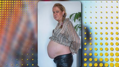 Diez años 'embarazada de nueve meses' al sufrir una distensión abdominal en el parto