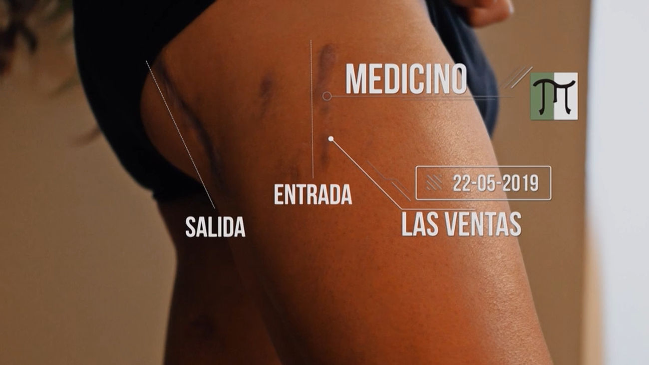 Gonzalo Caballero, un cuerpo cosido a cornadas