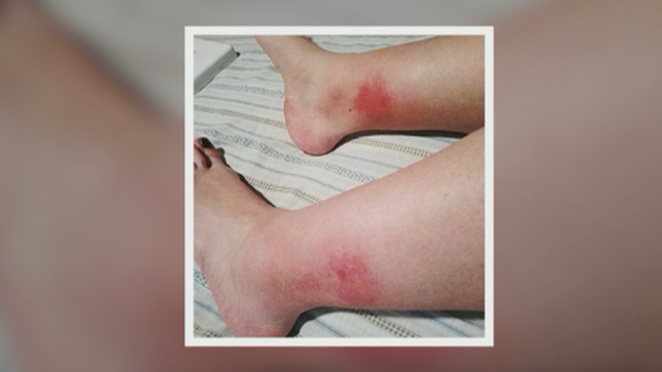 Vecinos de Villaverde denuncian las mordeduras que sufren de la mosca negra