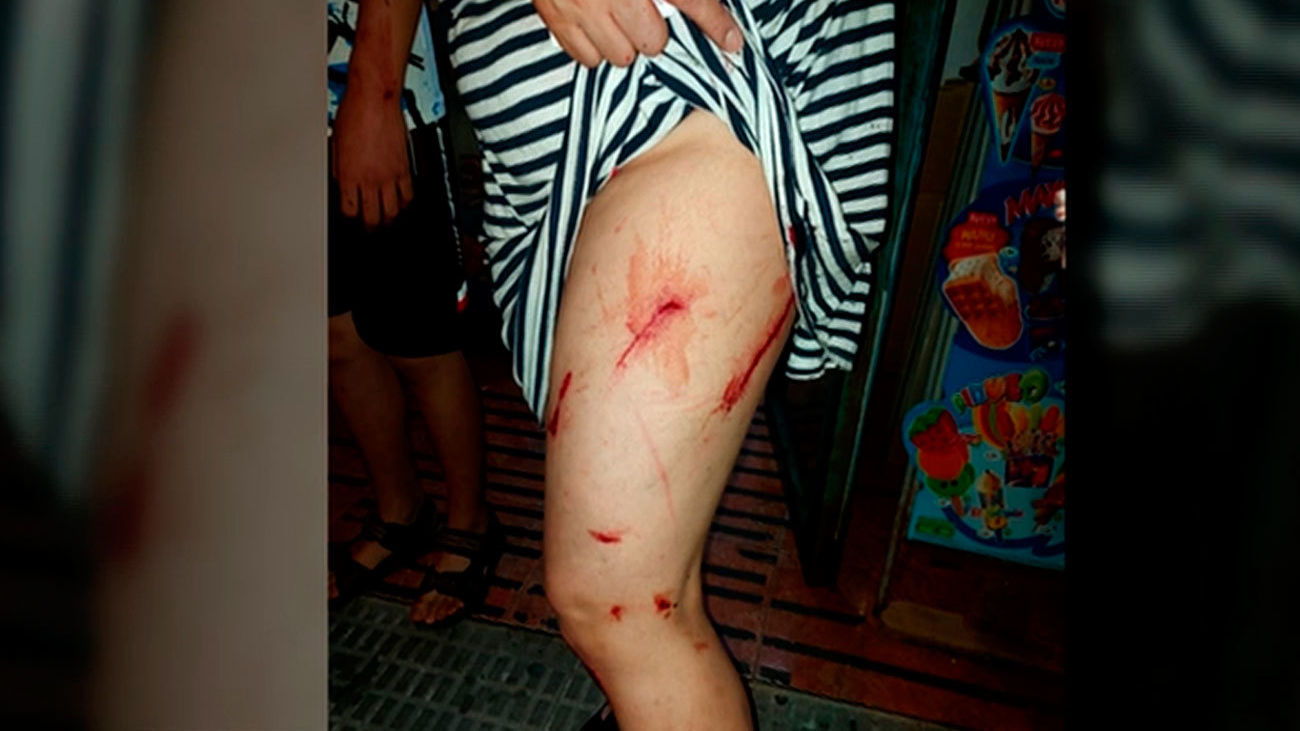 Los dueños de un comercio chino y su hijo agredidos en Parla por un grupo que no quería pagar