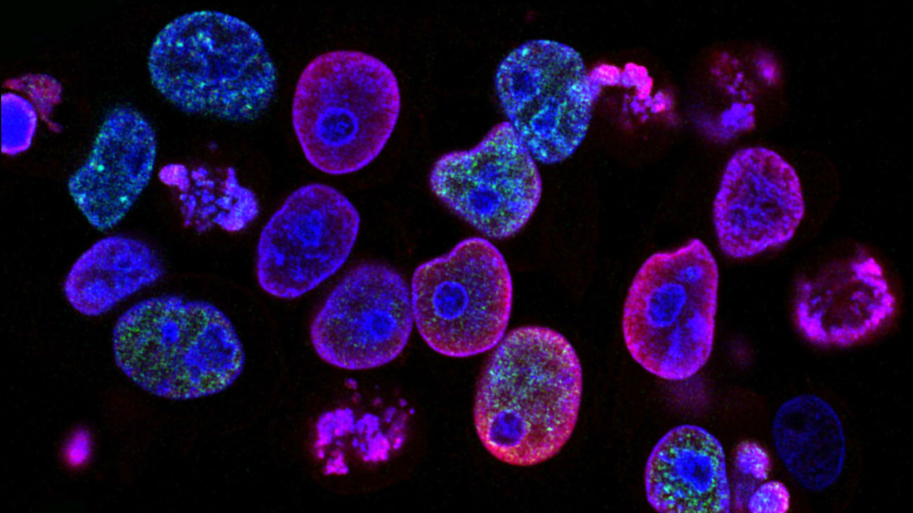 Un equipo del CSIC halla una vía para frenar los tumores