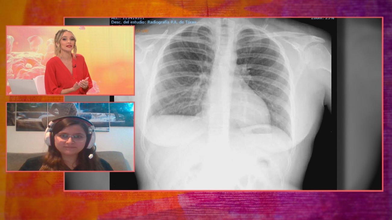 Una joven de 25 años lleva 10 meses con covid persistente