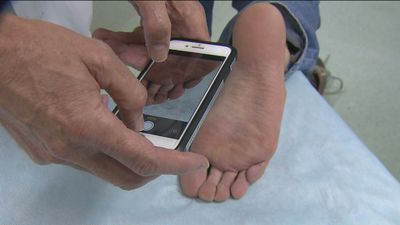 Una app se convierte en tu dermatólogo de bolsillo para el seguimiento de lesiones en la piel