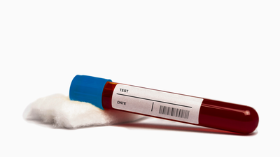 Melio, la startup que ofrece información sobre la salud de tu sangre mediante analíticas