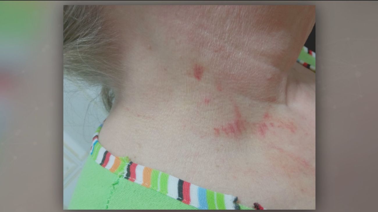 Nueva víctima del método del 'mataleón': "Me asfixió hasta que perdí el conocimiento"