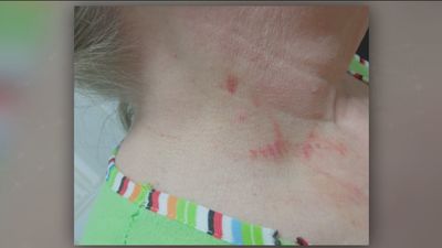 Nueva víctima del método del 'mataleón': "Me asfixió hasta que perdí el conocimiento"