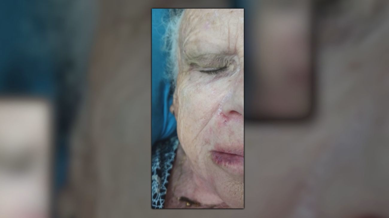 Una vecina de 81 años sufre una caída por el pésimo estado de las aceras, en Alcorcón