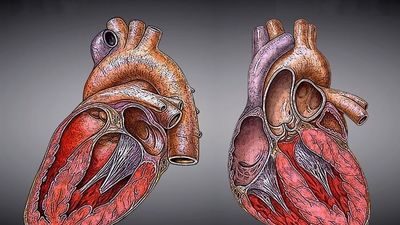 El 5% de los pacientes de infarto agudo tiene daños en el corazón a largo plazo
