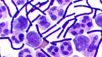 Covid, fiebre del Nilo...y ahora ántrax