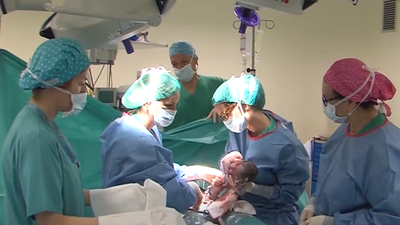 Uno de cada cuatro partos en España acaba en cesárea