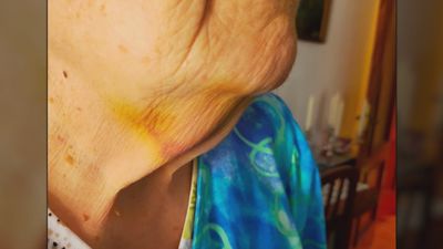 Una mujer de 90 años, nueva víctima del método 'mataleón'