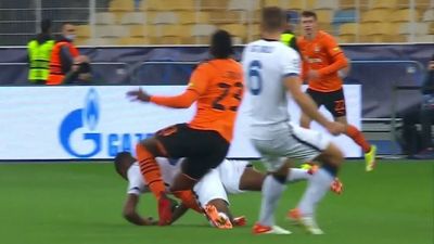 Escalofriante lesión de Lassina Traoré en el Shakhtar-Inter