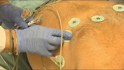 Aumentan con la Covid las muertes por infarto