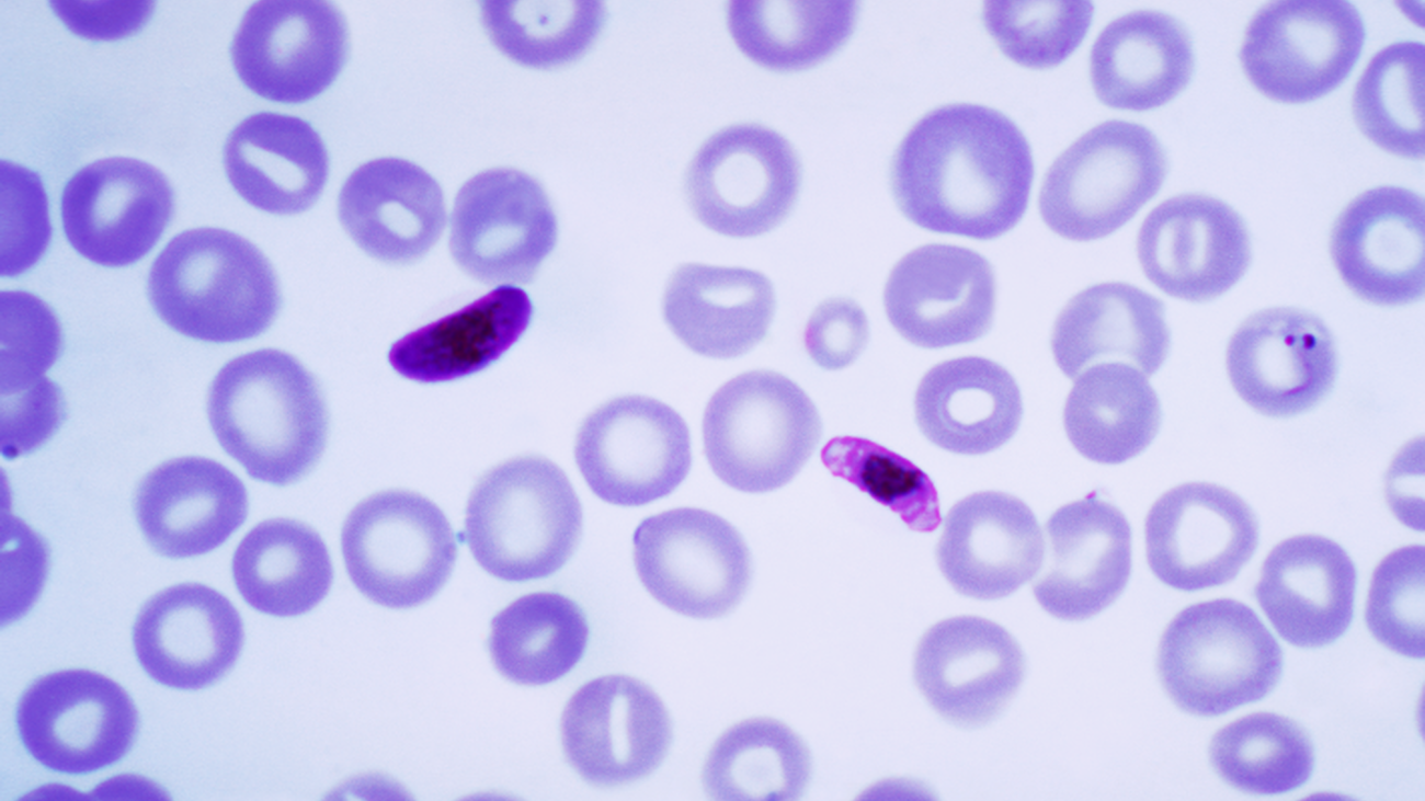 Plasmodium falciparum en una imagen micróscopica