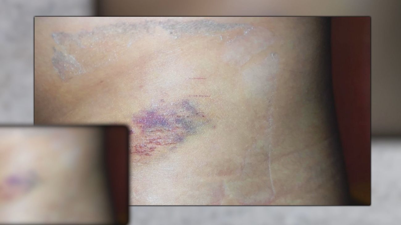 Agredidos por los porteros de una discoteca de Las Rozas