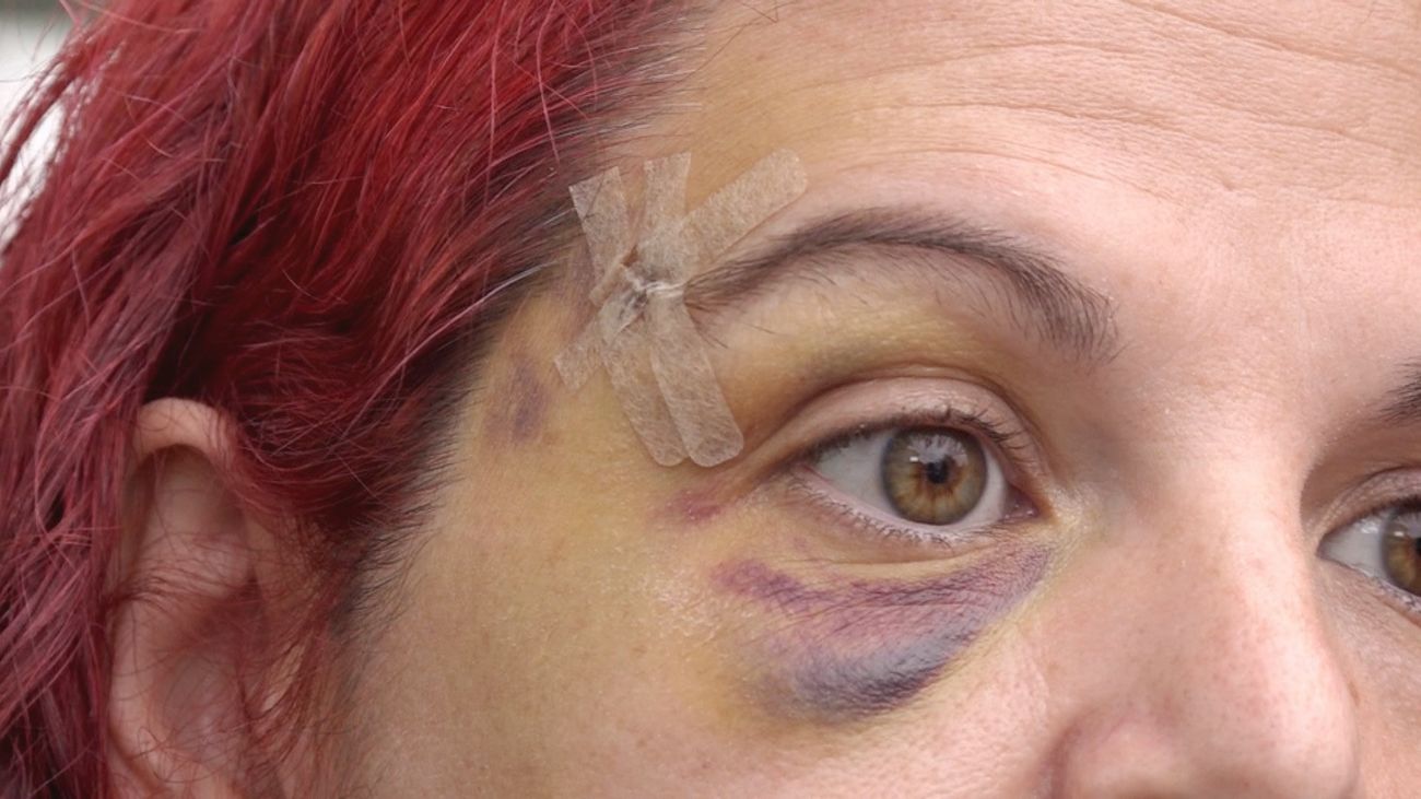 Se destroza el rostro por el mal estado de las aceras en Entrevías